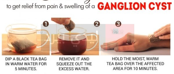 black-tea-ganglion-600x335