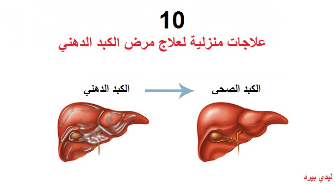 fattyliver